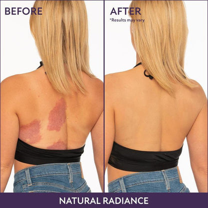 Resplenza™ Flawless Body Coverage Perfector